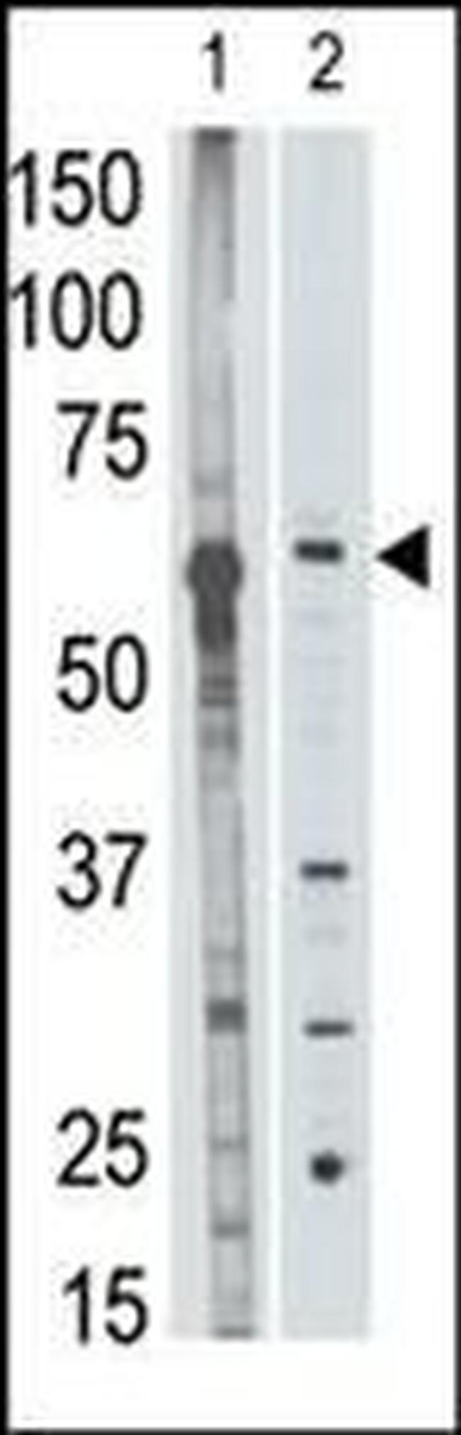 MMP25 Antibody in Western Blot (WB)