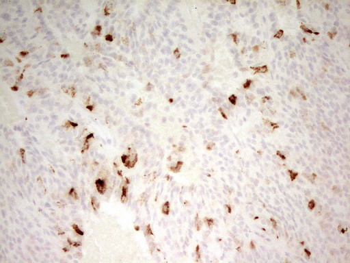 MMP3 Antibody in Immunohistochemistry (Paraffin) (IHC (P))