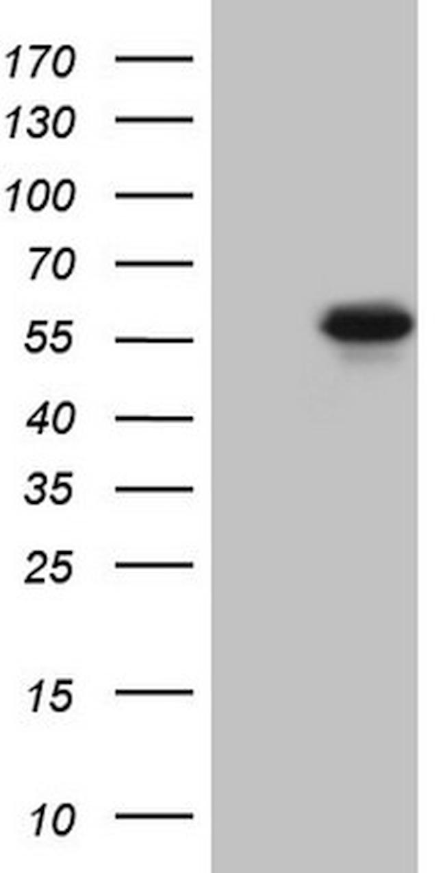 MMP3 Antibody in Western Blot (WB)