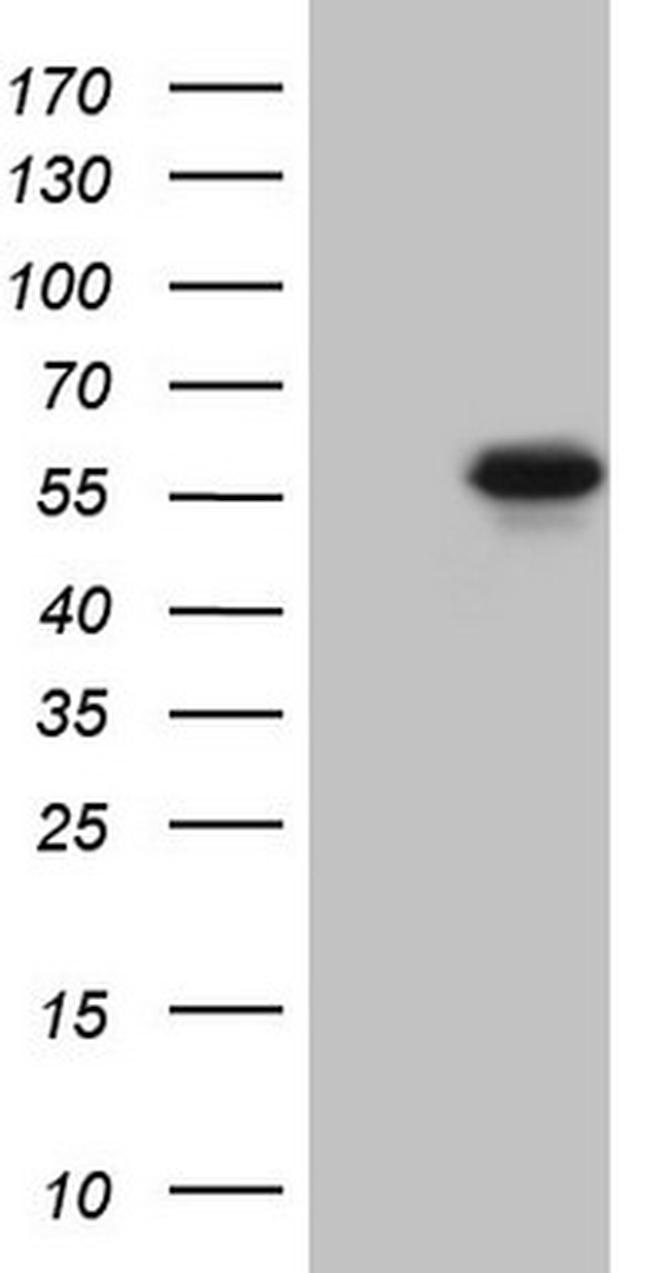 MMP3 Antibody in Western Blot (WB)