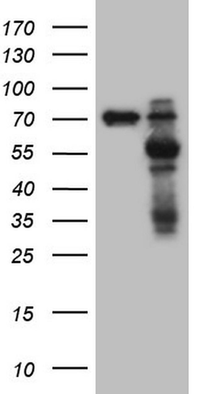 MMP3 Antibody in Western Blot (WB)