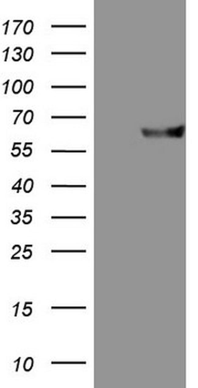 MMP3 Antibody in Western Blot (WB)