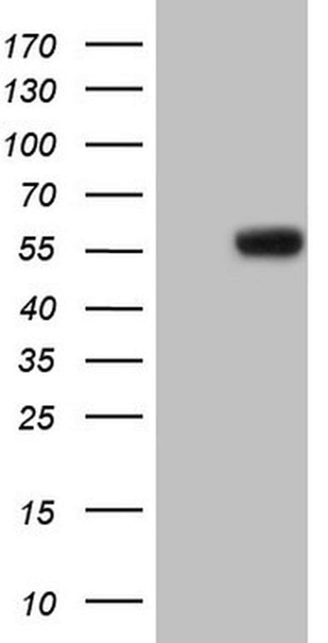 MMP3 Antibody in Western Blot (WB)