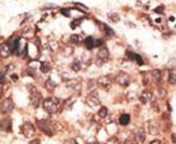 MMP8 Antibody in Immunohistochemistry (IHC)