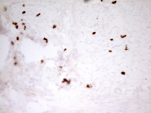 MNDA Antibody in Immunohistochemistry (Paraffin) (IHC (P))