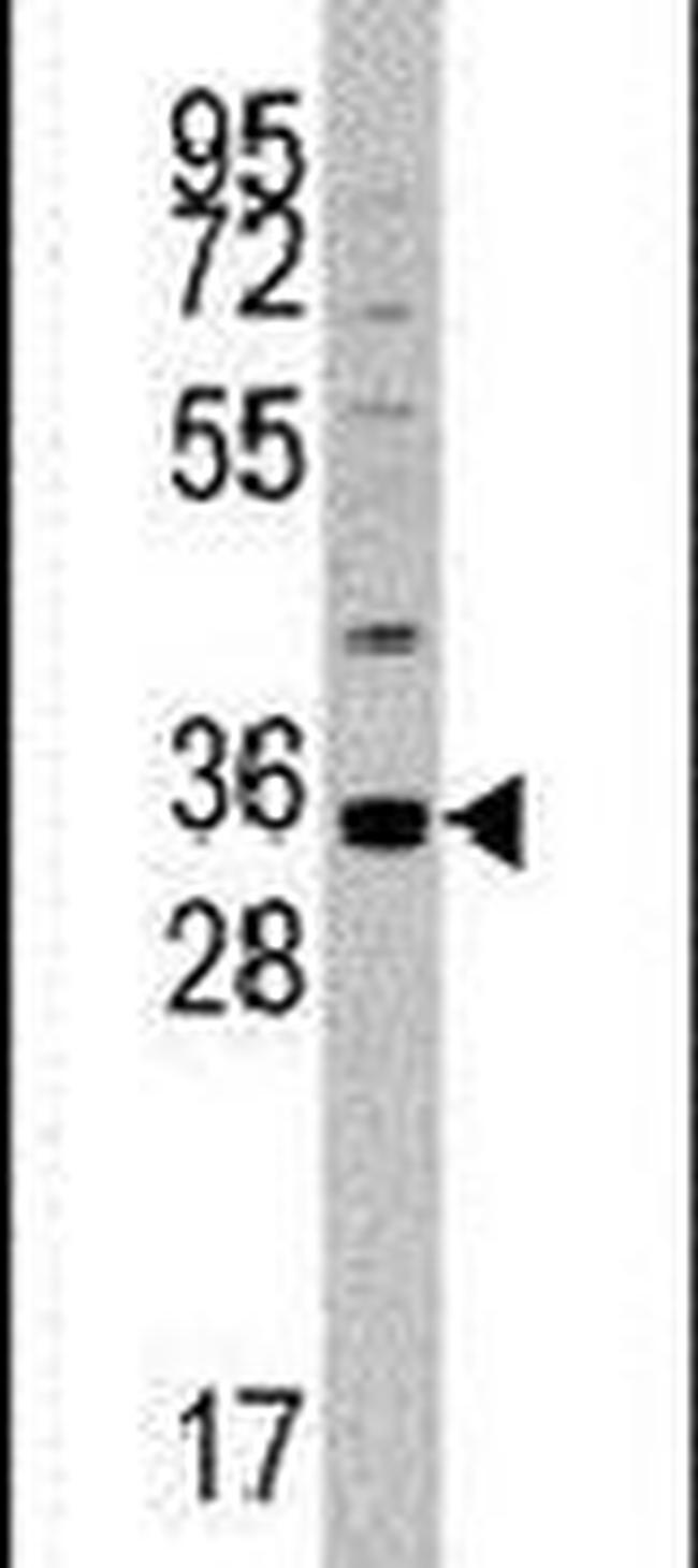 MOGAT2 Antibody in Western Blot (WB)
