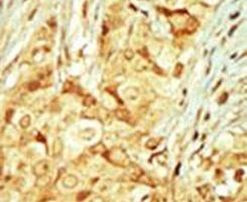MOK Antibody in Immunohistochemistry (IHC)
