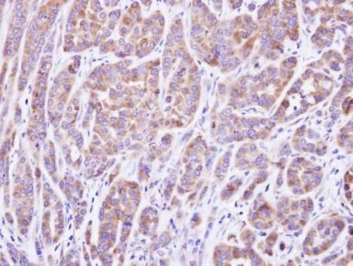 MOK Antibody in Immunohistochemistry (Paraffin) (IHC (P))