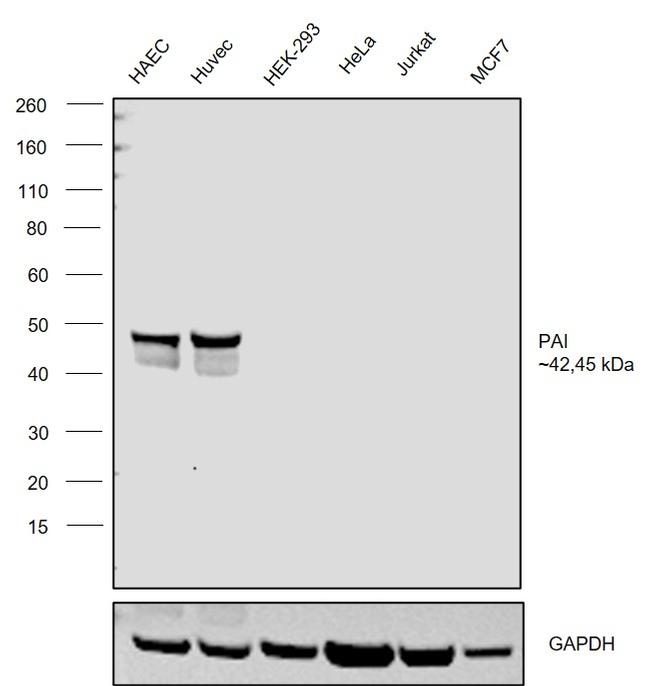 PAI1 Antibody in Western Blot (WB)