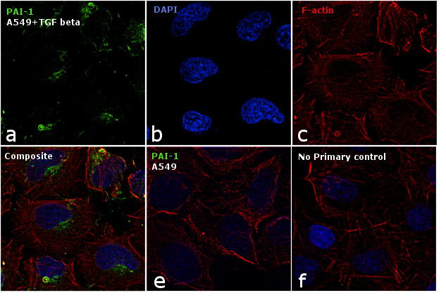 PAI1 Antibody in Immunocytochemistry (ICC/IF)