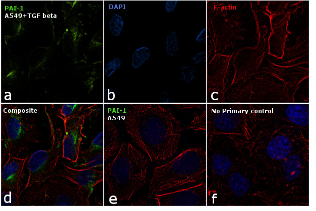 PAI1 Antibody in Immunocytochemistry (ICC/IF)