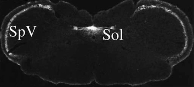 OPRM1 Antibody in Immunohistochemistry (IHC)