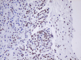 MORF4 Antibody in Immunohistochemistry (Paraffin) (IHC (P))