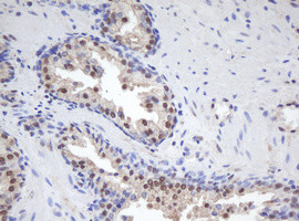 MORF4 Antibody in Immunohistochemistry (Paraffin) (IHC (P))