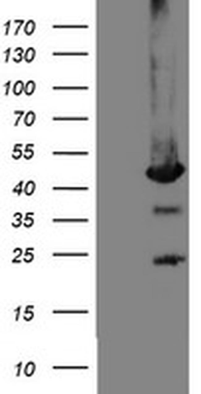 MPI Antibody in Western Blot (WB)