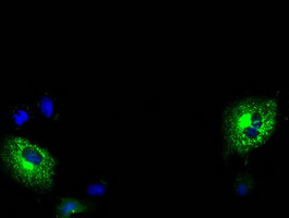 MPP3 Antibody in Immunocytochemistry (ICC/IF)