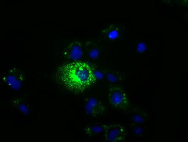 MPP3 Antibody in Immunocytochemistry (ICC/IF)