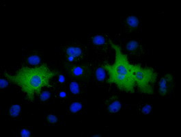 MPP3 Antibody in Immunocytochemistry (ICC/IF)