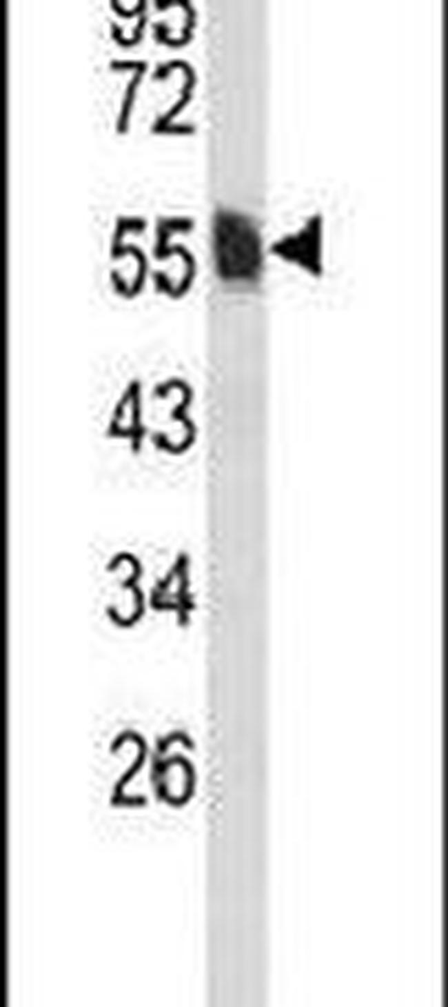 VAM1 Antibody in Western Blot (WB)
