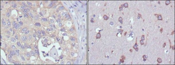 MPS1 Antibody in Immunohistochemistry (Paraffin) (IHC (P))