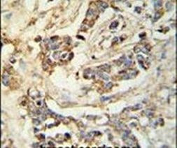 MRAP Antibody in Immunohistochemistry (IHC)
