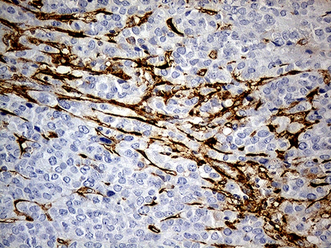 MRC2 Antibody in Immunohistochemistry (Paraffin) (IHC (P))