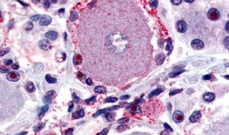 MRGPRX2 Antibody in Immunohistochemistry (Paraffin) (IHC (P))