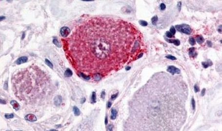 MRGPRX2 Antibody in Immunohistochemistry (Paraffin) (IHC (P))