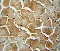 MRM1 Antibody in Immunohistochemistry (IHC)