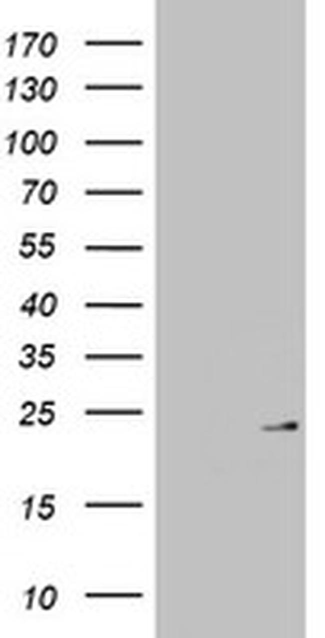 MRPL13 Antibody in Western Blot (WB)