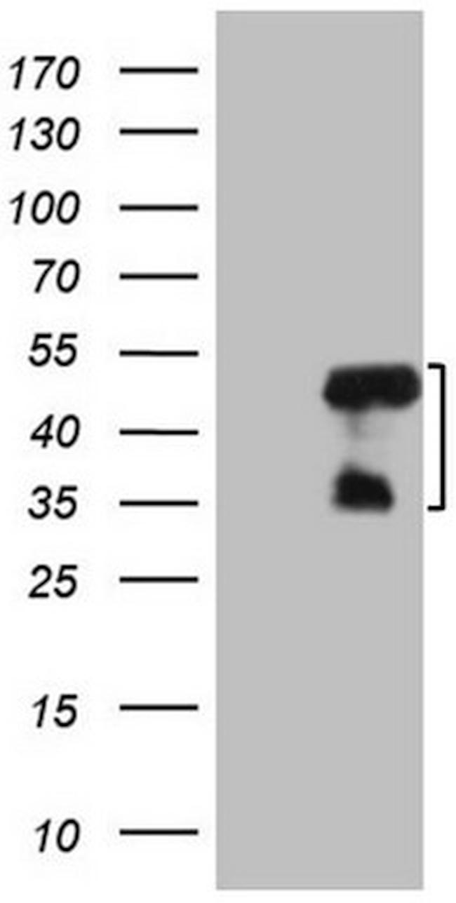 MRPL15 Antibody in Western Blot (WB)