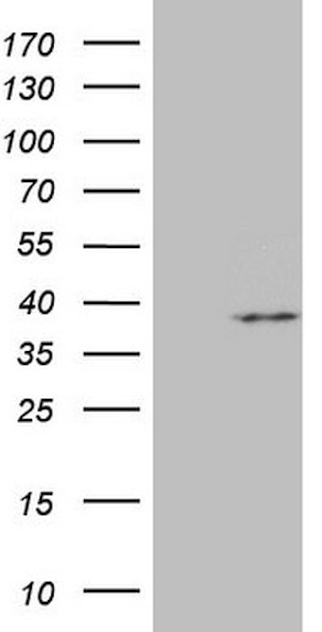MRPL15 Antibody in Western Blot (WB)