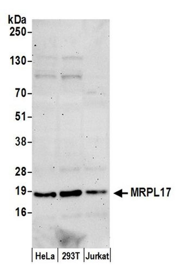 MRPL17 Antibody in Western Blot (WB)
