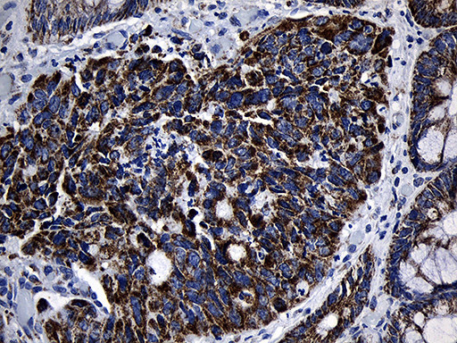 MRPL48 Antibody in Immunohistochemistry (Paraffin) (IHC (P))