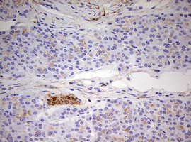 MRPS11 Antibody in Immunohistochemistry (Paraffin) (IHC (P))