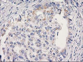 MRPS2 Antibody in Immunohistochemistry (Paraffin) (IHC (P))