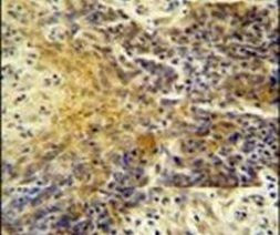 MRPS24 Antibody in Immunohistochemistry (IHC)