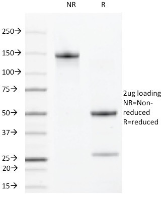 VEGF-R2/CD309/Flk-1/KDR3 Antibody in SDS-PAGE (SDS-PAGE)