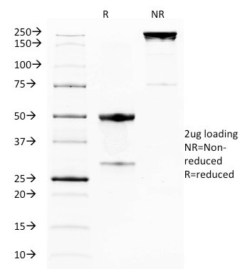 GITR/Tnfrsf18 Antibody in SDS-PAGE (SDS-PAGE)