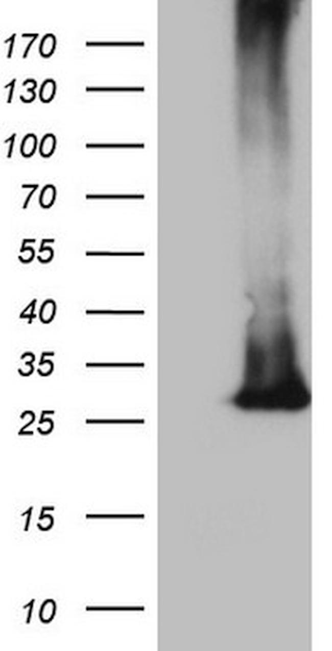 MS4A12 Antibody in Western Blot (WB)