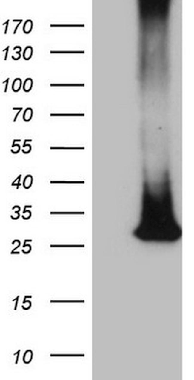 MS4A12 Antibody in Western Blot (WB)