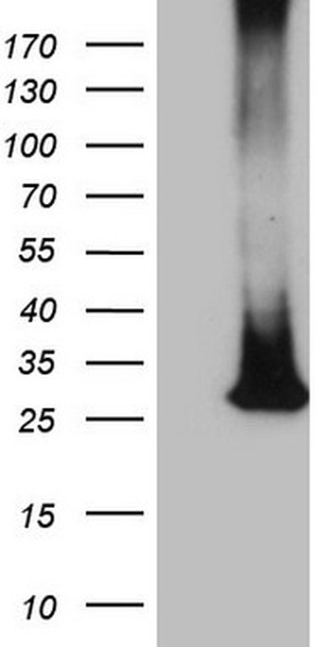 MS4A12 Antibody in Western Blot (WB)