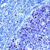 MSH2 Antibody in Immunohistochemistry (IHC)