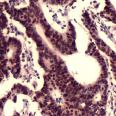 MSH2 Antibody in Immunohistochemistry (IHC)