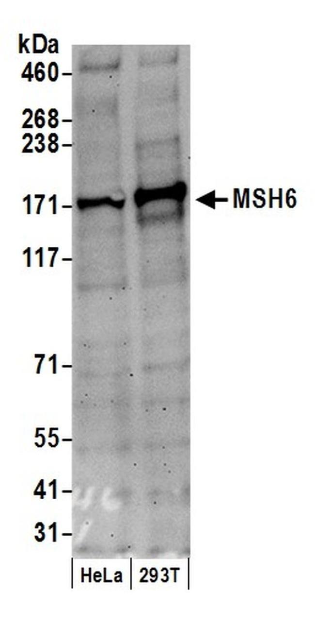 MSH6 Antibody in Western Blot (WB)