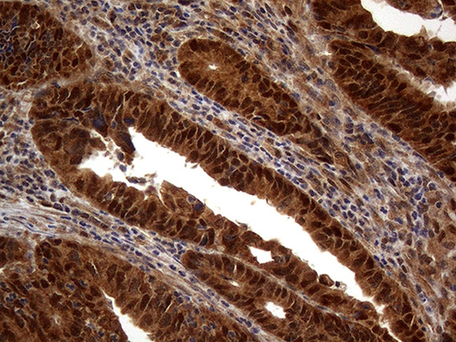 MSH6 Antibody in Immunohistochemistry (Paraffin) (IHC (P))