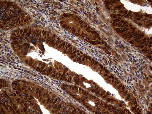 MSH6 Antibody in Immunohistochemistry (Paraffin) (IHC (P))
