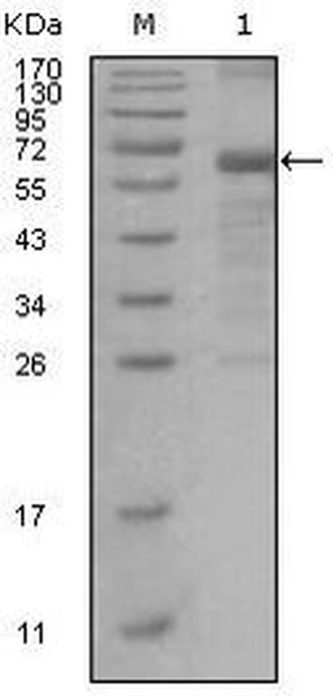 MSH6 Antibody in Western Blot (WB)