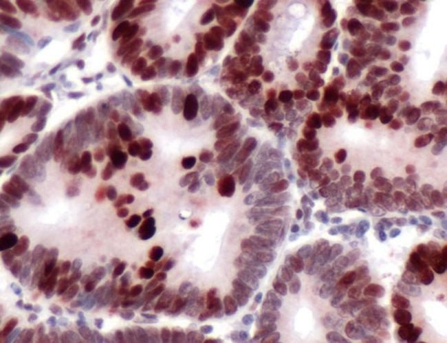 MSH6 Antibody in Immunohistochemistry (Paraffin) (IHC (P))