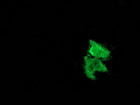 MSI1 Antibody in Immunocytochemistry (ICC/IF)